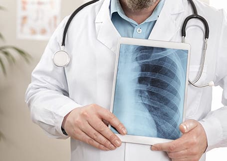 medico especialista en enfermedades pulmonares